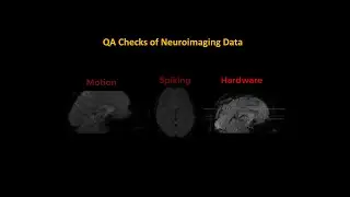 Quality Checks for fMRI Data