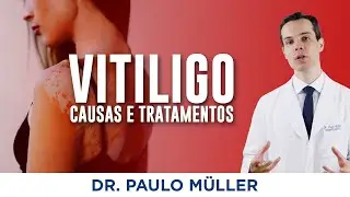 Vitiligo - O que voc&ecirc; precisa saber sobre essa doen&ccedil;a! - Dr. Paulo M&uuml;ller Dermatologista