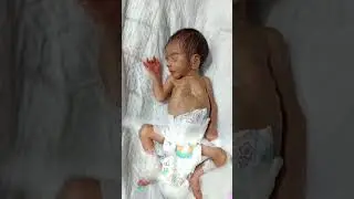 NICU Care for LBW Baby | Heartwarming Progress 🍼#viral #nicubaby #viralvideo #newborncare #shorts