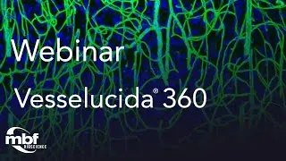 Webinar: Reconstructing Vasculature & Obtaining Data using Vesselucida 360 and Vesselucida Explorer