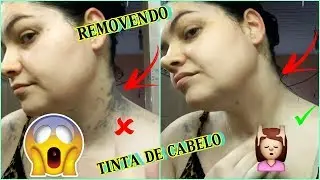 COMO TIRAR TINTA DE CABELO DA PELE