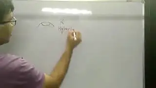 Park 3 Step Test II Neuro-ophthalmology II Nerve Palsy
