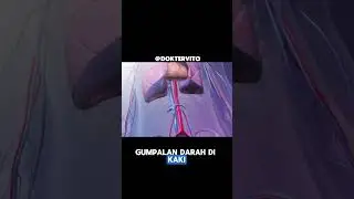 Deep Vein Thrombosis dan Pulmonary Embolism, Sumbatan Jantung yang Bukan Serangan Jantung #drv