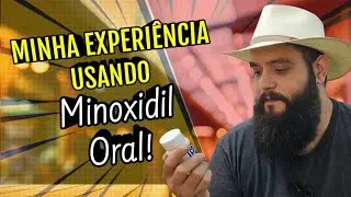 MINHA EXPERIÊNCIA USANDO MINOXIDIL ORAL - (DAVID_BLACKBEARD)