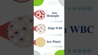 𝗨𝗻𝗱𝗲𝗿𝘀𝘁𝗮𝗻𝗱𝗶𝗻𝗴 𝗖𝗕𝗖 (𝗖𝗼𝗺𝗽𝗹𝗲𝘁𝗲 𝗕𝗹𝗼𝗼𝗱 𝗖𝗼𝘂𝗻𝘁)