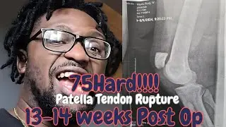 The Journey: Rupture Pattella Tendon Post-Op Recovery Week 13-14 Update.