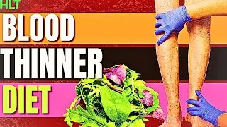 Foods to Avoid When Using Blood Thinners