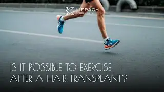 Is it possible to exercise after a hair transplant?