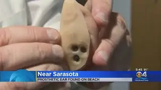 Florida Police Find Owner Of Prosthetic Ear Found On Beach