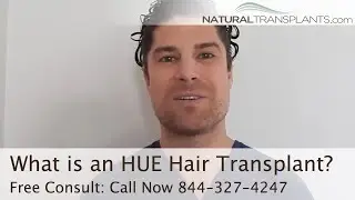 What is an HUE (High-Yield Unit Extraction&reg;) Hair Transplant? | Hair Restoration Miami
