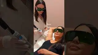 Laser Haarentfernung Achseln - Wow-Effekt ab der 1. Sitzung! #laserhaarentfernung #laserhairremoval