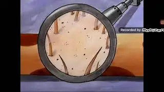 CatDog: CatDog gets fleas