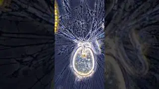 Фортицелла &mdash; микроскопический хищник с щупальцами #микроскоп #biology