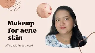 ✨😳Pimple wali skin par Makeup #makeup #grwm 