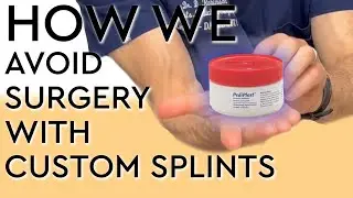 How We Avoid Surgery with Custom Splints