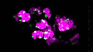 Plasmodium falciparum schizont (Hoechst - magenta, telomeres - green) OMX SIM