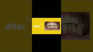 The Dental Care by Dr. Pankhuri Gupta Sharma | Smile Makeover | #dentist #dentistry #dental #teeth
