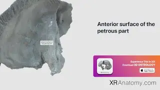 Temporal Bone   Anterior surface of petrous part