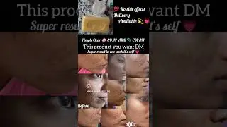 PIMPLE Clear SOAP 🧼 AND 🫧 CREAM