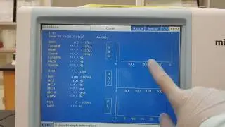 Гематология: Сброс кодов ошибок на Mindray BC 3200, часть 1