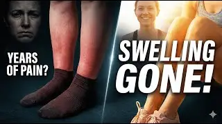 Swollen Legs & Feet for Years? This Simple Habit Changed Everything