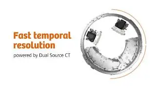 Computed Tomography Dual Source CT - Fast Temporal Resolution