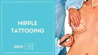 Nipple Tattooing