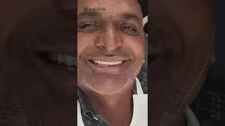 From missing teeth to a confident smile. Full Mouth Implant Rehabilitation.