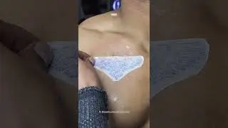 Eagle Cover-Up Tattoo | Powerful Eagle Art Tattoo Transformation