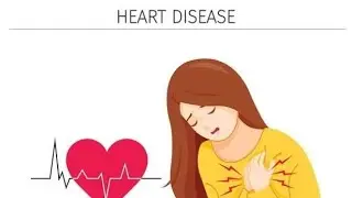 Lecture 96 # OB-GYN | Cardiac disease in pregnancy