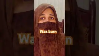 Wax burn#dermatologist#trendingshorts#skincare