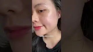 For those afraid of chemical peels because of stinging and flaking, come on in! This Garnier seru...