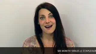 Teeth Straightening with Six Month Smiles Clear Braces
