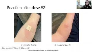January 13, 2023: JYNNEOS Vaccine - Jones, Goldscheider