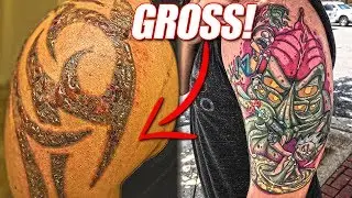 Tattoo Removal Goes WRONG! & Finished Tattoo