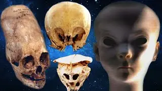 THESE SKULLS SHOULDN'T EXIST - Alien or Hybrid Beings?