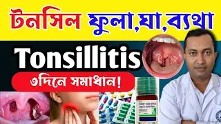 গলাতে ব্যথা যন্ত্রণা টনসিল ফুলে আছে কি করবেন| টনসিলের সমস্যা হলে কি করবেন|