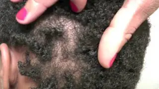 Natural Black Hair Care | 