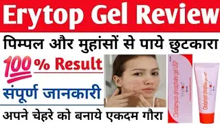 Erytop Gel | Erytop Gel Uses, Dosage and side effects in hindi | Erytop Gel Review | Erytop lotion