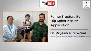 Treatment Of Femur Fracture By Hip Spica Plaster Application.