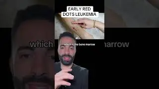 Signs of leukemia