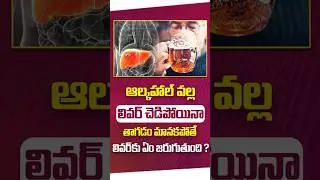 How Alcohol Damages the Liver | Stages of Liver Damage | Vidhata #shorts #liverdamage #alcohol