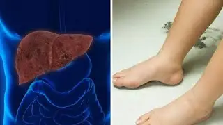 Calaamadaha lagu garto in beerka ka jiran tahay &hellip;