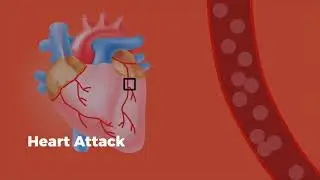 Advanced Cardiac Health Chcekup Services