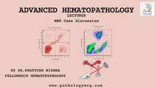 Master MRD Assessment in B-Cell ALL:Case Studies & Flow Cytometry PatternsI Advanced hematopathology