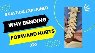 Why Bending Forward Will Not Help || Sciatica Explained By Chris Erickson The Herniated Disc Expert