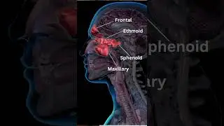 What is Sinusitis? Common myths on sinusitis and sinus surgery: clarified by Dr. Madhukar Vashistha.