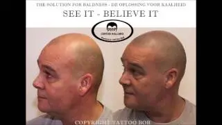 Micro Haar Pigmentatie - Stoppeltattoo