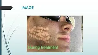 Experience the Best Male Brazilian waxing in Langwarrin.