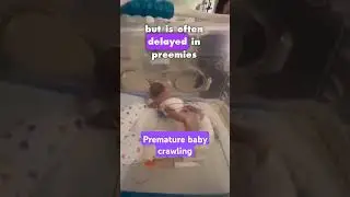 преждевременное ползание ребенка